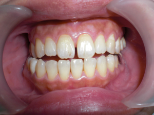 case02-1