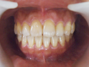 case02-2