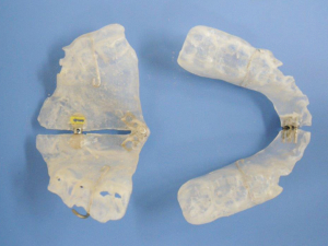 case02-3