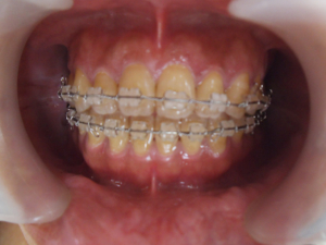case02-5