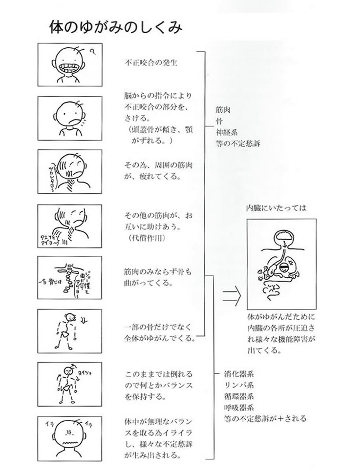 体のゆがみのしくみ