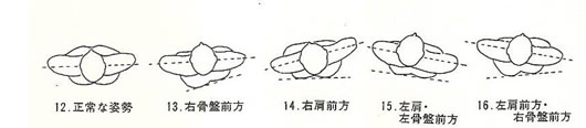 様々な歪み