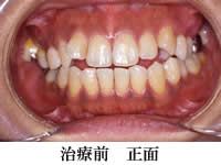 wiren_1