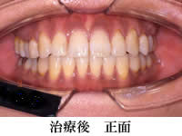 wiren_1