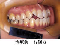 wiren_1