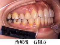 wiren_1