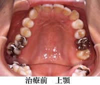 wiren_1